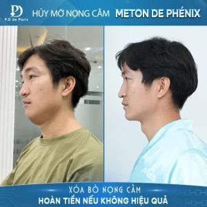 THẬT – CHẤT – HIỆU QUẢ chính là những gì P.D de Paris đem đến trong từng liệu trình chăm sóc sắc đẹp...